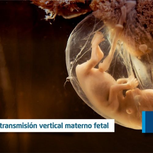 SARS-CoV-2: Evidencias de transmisión vertical materno fetal
